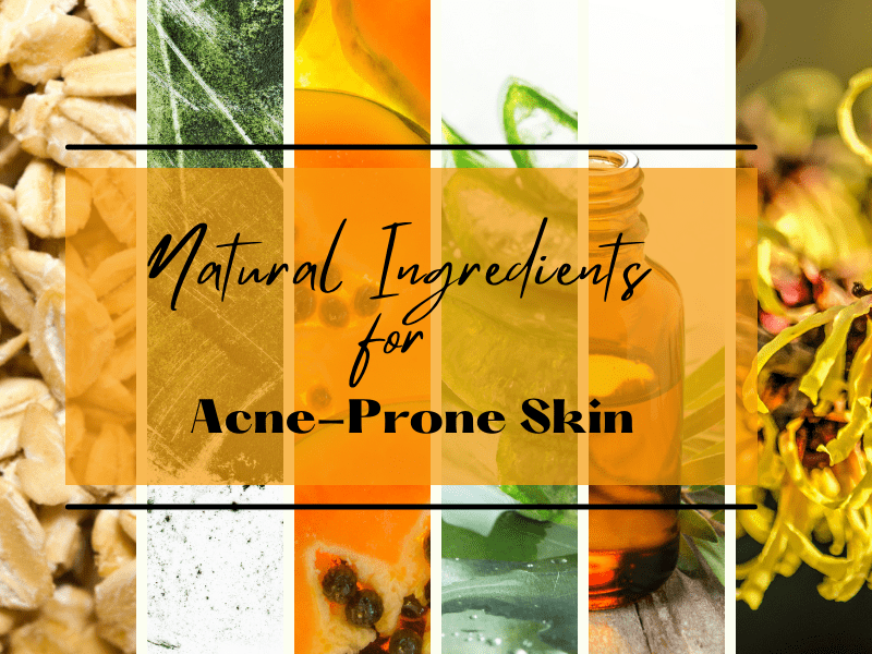 Natural Ingredients for Acne -Prone Skin